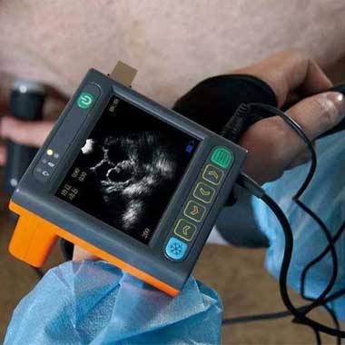 The Scan That Pays for the Feed